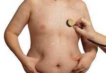 microbiomas