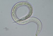 Este animal esconde claves para las enfermedades Neurodegenerativas gusanos redondos
