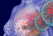 Científicos mexicanos desarrollan nuevos fármacos contra cáncer de mama cancer de mama