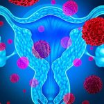 Estos tipos de cáncer suelen confundirse con otras afecciones cancer