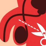 Efectos de la vasectomía en la vida sexual del hombre vasectomia