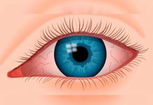 Síndrome de ojo seco, podría afectarte sin que lo sepas ojo seco