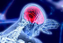 Crean «marcapasos cerebral» para tratar la epilepsia y el párkinson marcapasos cerebral