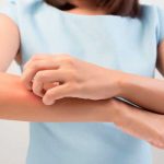 reacciones alergicas