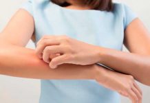 10 % de los adultos en EE.UU padece de alguna alergia alimenticia reacciones alergicas