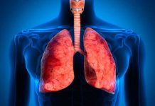 OJO: Por estas graves razones se llenan de agua los pulmones acumulacion de liquido en pulmones