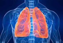 Por esta causa se puede agravar la hipertensión pulmonar diagnostico tardio