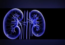 Dia del riñon: Conoce cuatro consejos para cuidar el organo vital