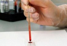 Día Mundial del Donante de Sangre ¿por qué se celebra el 14 de junio? dia mundial