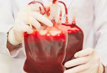 ¡Atención! Transfusión de sangre joven no es más que una estafa transfusion