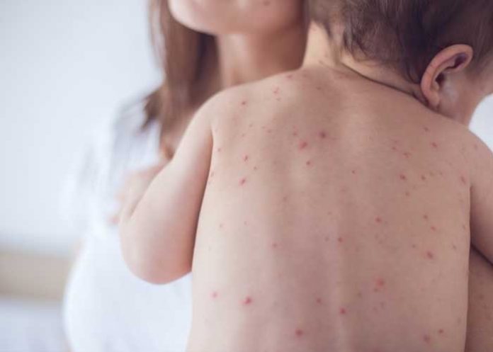 organizacion mundial de la salud