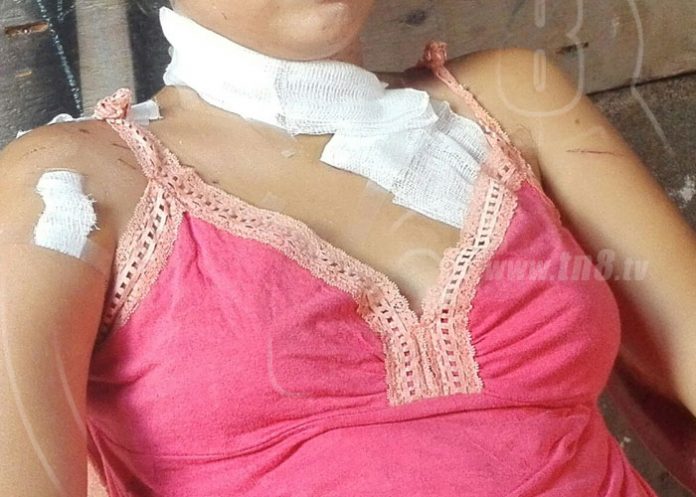 secuela-agresion-femicidio-02 nicaragua