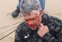 Buzo se dispara accidentalmente en la cabeza con una lanza de pesca (VIDEO) buzo