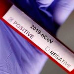 Suecia confirma el primer caso de contagio del coronavirus suecia