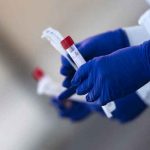 Taiwán dona pruebas para coronavirus y 10 respiradores a Guatemala guatemala