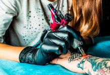 ¿Cuál es el mejor método para eliminar un tatuaje?
