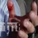 Taxista herido con arma blanca por intento de asalto en Juigalpa nicaragua, asalto, juigalpa, chontales, agresion,