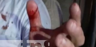 nicaragua, asalto, juigalpa, chontales, agresion,
