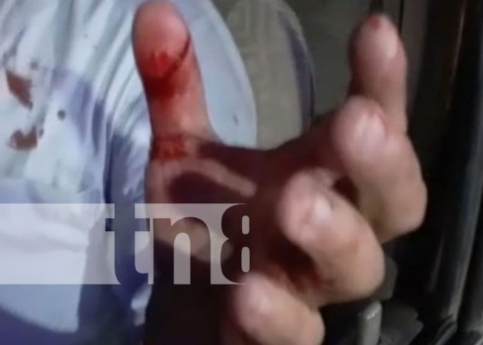 nicaragua, asalto, juigalpa, chontales, agresion,