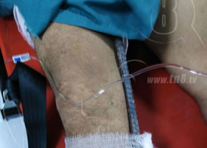 testiculo-varilla-01 nicaragua