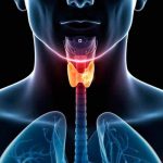 Hallan una nueva diana terapéutica para el cáncer de tiroides cancer de tiroides