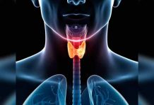 Los desórdenes más comunes en la tiroides cancer de tiroides