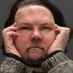 Víctima de accidente tiene el primer trasplante de cara y manos en EEUU estados unidos