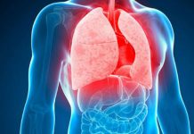 Con buena alimentación y ventilación puedes prevenir la tuberculosis salud