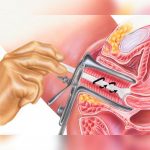 11 datos curiosos que toda mujer debe saber sobre el Papanicolau vida sexual