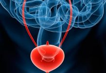 Estudio acerca de las terapias a los pacientes con cáncer de vejiga estudio