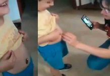 Se traga un imán y esto hacen sus padres para intentar ayudarlo video