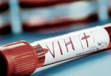 Prevén contagios y muertes por VIH tras falta de medicinas contagios