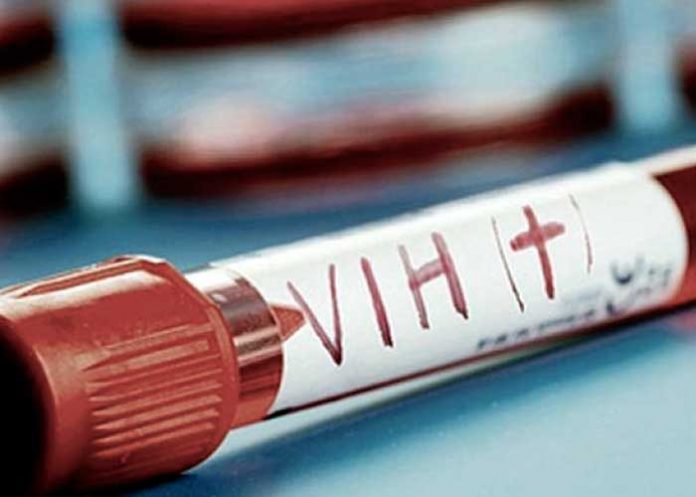 vih_6cvlkn0 contagios