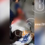 Accidente de tránsito deja a mujer con pierna cercenada en Managua nicaragua