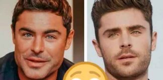 cirugia, rostro, zac efron, viral, criticas, instagram, dia de la tierra,