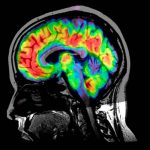 ¿Cuál es la enfermedad más rara del mundo?