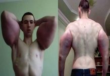 Ruso se inyecta aceite en los brazos para ser el ‘Popeye humano’