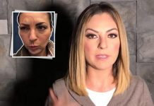 Mariana Ochoa con el rostro afectado por ¡Tratamiento cosmético!