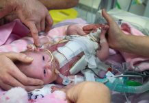 Bebé que nació con el corazón fuera sobrevive a tres cirugías