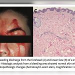 Estudian caso de italiana que suda sangre