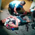 Motociclista y pasajero resultan lesionados al estrellarse en Carretera Norte