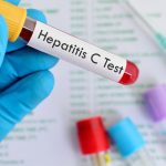 Poco acceso a tratamiento complican cura de la Hepatitis C