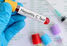 Poco acceso a tratamiento complican cura de la Hepatitis C