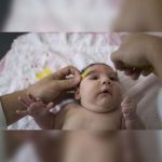 Estudian efectos del zika en infantes de Guatemala