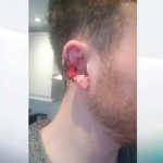 Londres: Se cree Mike Tyson y le muerde la oreja a pasajero porque hablaba por celular