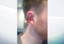 Londres: Se cree Mike Tyson y le muerde la oreja a pasajero porque hablaba por celular