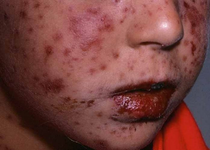 Sin_titulo-1_77hRFHP