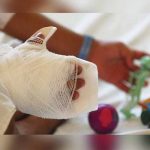 El Salvador: Reportan nueve quemados en Nochebuena