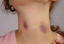 Argentina: Adolescente intenta matar a su novia tras mirarla chupeteada