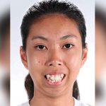 Chavala que sufría bullying, gana operación y ahora es una diva de la belleza